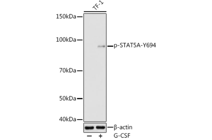 Western Blot - Anti-STAT5 (phospho Tyr694) Antibody (A16466) - Antibodies.com