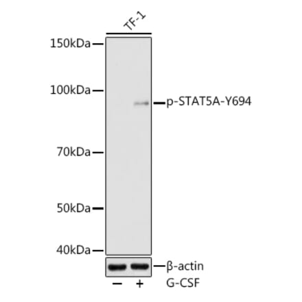 Western Blot - Anti-STAT5 (phospho Tyr694) Antibody (A16466) - Antibodies.com