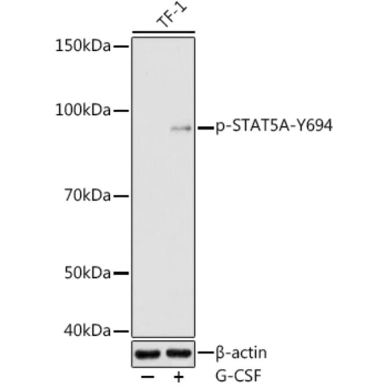 Western Blot - Anti-STAT5 (phospho Tyr694) Antibody (A16466) - Antibodies.com