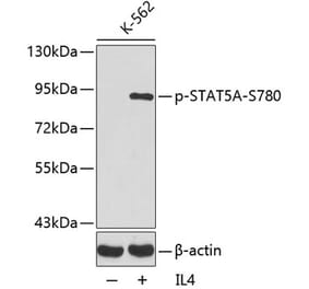 Western Blot - Anti-STAT5 (phospho Ser780) Antibody (A16467) - Antibodies.com