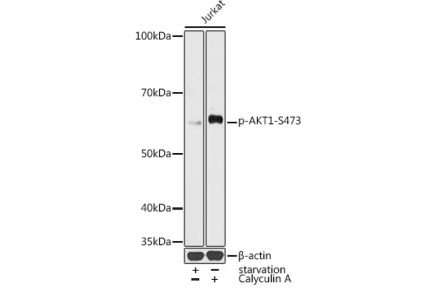 Western Blot - Anti-AKT1 (phospho Ser473) Antibody (A16468) - Antibodies.com