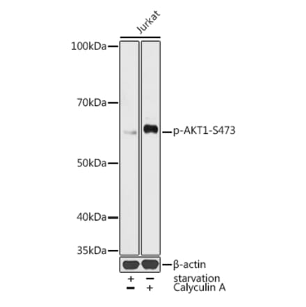 Western Blot - Anti-AKT1 (phospho Ser473) Antibody (A16468) - Antibodies.com