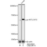 Western Blot - Anti-AKT1 (phospho Ser473) Antibody (A16468) - Antibodies.com