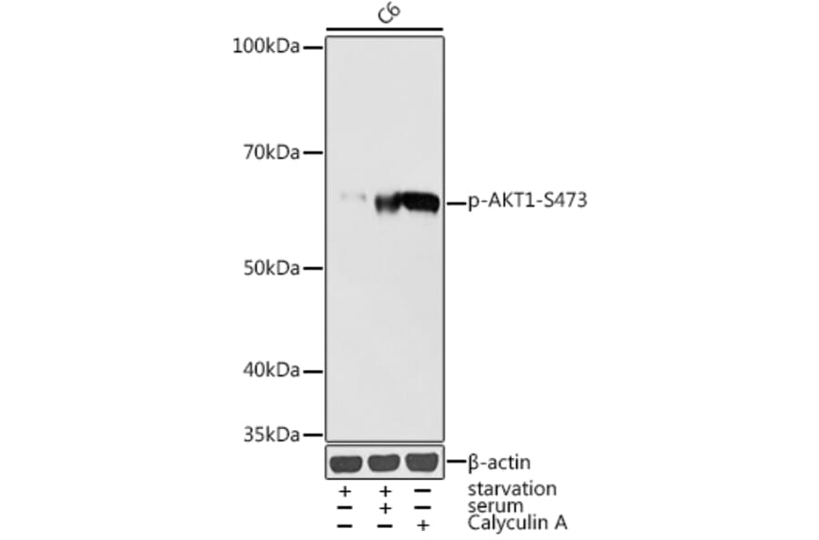 Western Blot - Anti-AKT1 (phospho Ser473) Antibody (A16468) - Antibodies.com