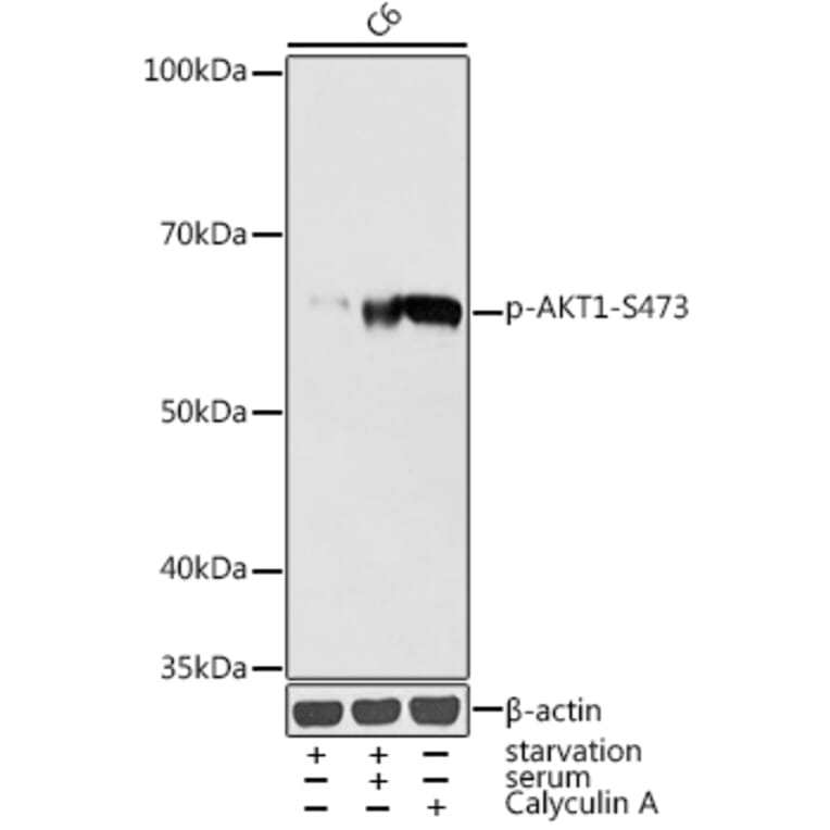 Western Blot - Anti-AKT1 (phospho Ser473) Antibody (A16468) - Antibodies.com