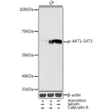 Western Blot - Anti-AKT1 (phospho Ser473) Antibody (A16468) - Antibodies.com