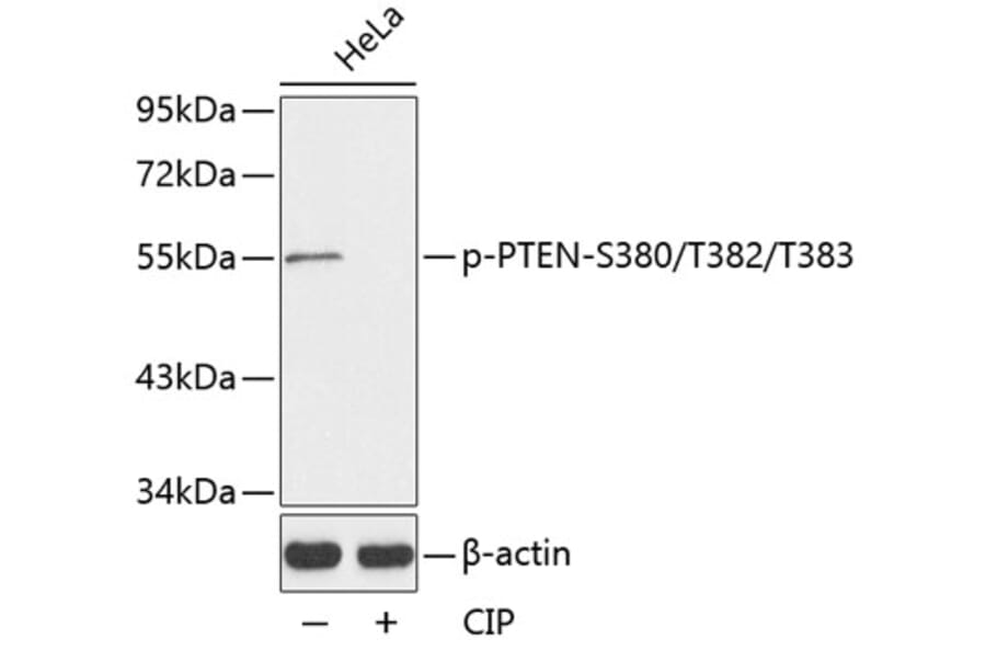 Western Blot - Anti-PTEN (phospho S380 + T382 + T383) Antibody (AP0141) - Antibodies.com