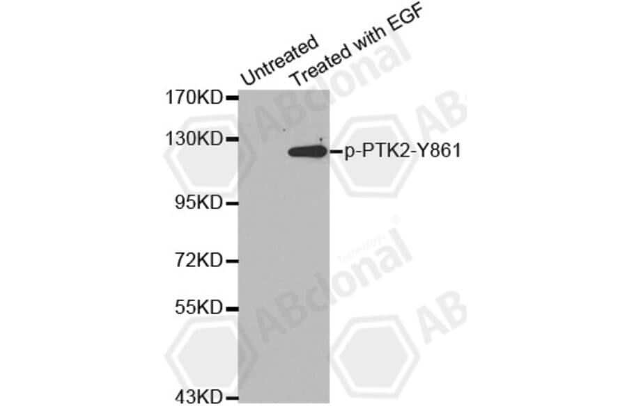 Western Blot - Anti-PTK2 (phospho Y861) Antibody (AP0142) - Antibodies.com