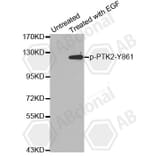 Western Blot - Anti-PTK2 (phospho Y861) Antibody (AP0142) - Antibodies.com