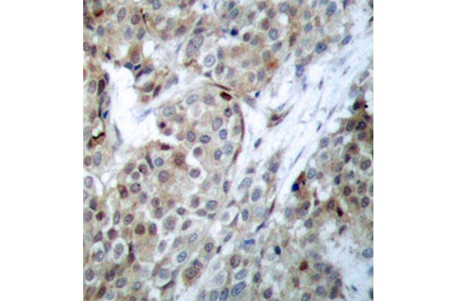 Immunohistochemistry - Anti-Bad (phospho S112) Antibody (AP0143) - Antibodies.com