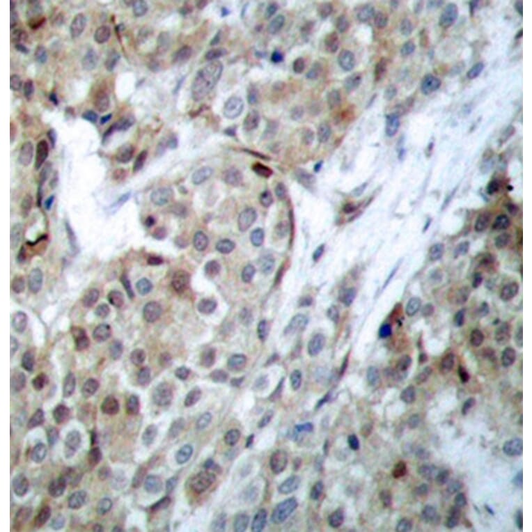 Immunohistochemistry - Anti-Bad (phospho S112) Antibody (AP0143) - Antibodies.com