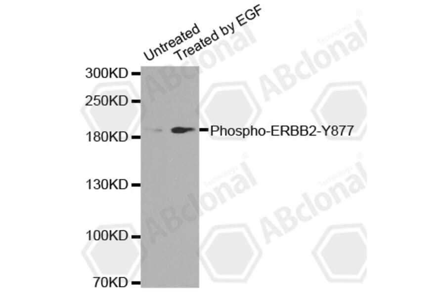 Western Blot - Anti-ERBB2 (phospho Y877) Antibody (AP0148) - Antibodies.com