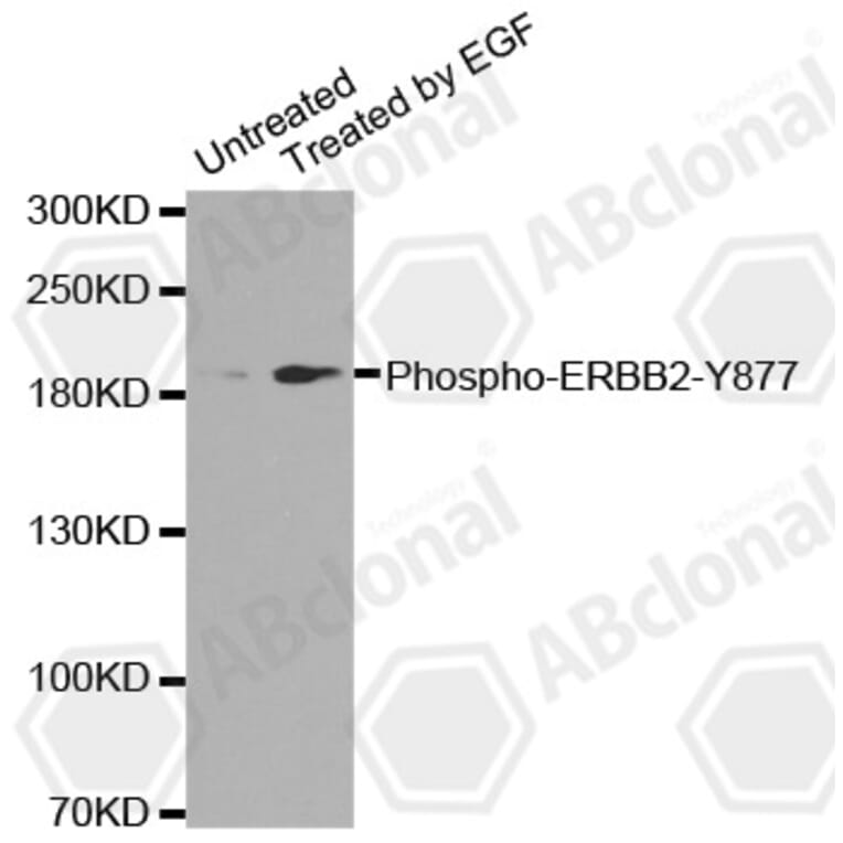 Western Blot - Anti-ERBB2 (phospho Y877) Antibody (AP0148) - Antibodies.com