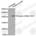 Western Blot - Anti-ERBB2 (phospho Y877) Antibody (AP0148) - Antibodies.com