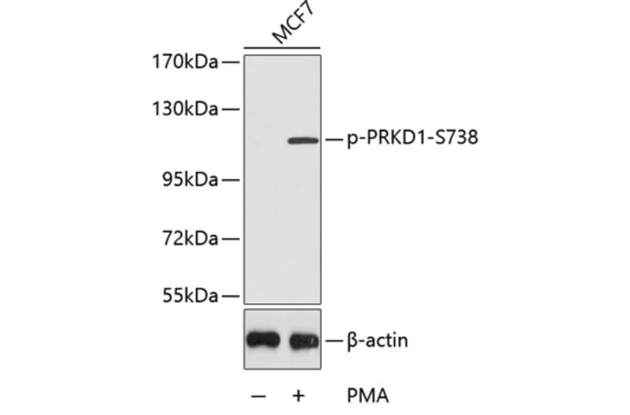 Western Blot - Anti-PRKD1 (phospho S738) Antibody (AP0151) - Antibodies.com