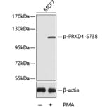 Western Blot - Anti-PRKD1 (phospho S738) Antibody (AP0151) - Antibodies.com