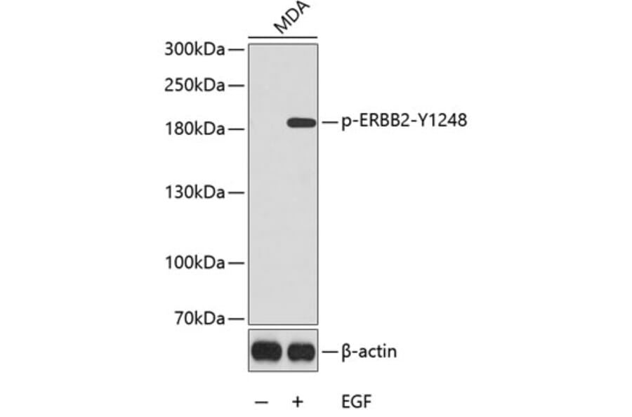 Western Blot - Anti-ERBB2 (phospho Y1248) Antibody (AP0152) - Antibodies.com
