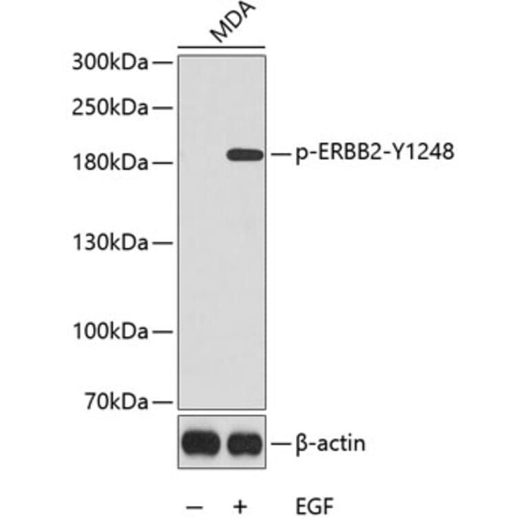 Western Blot - Anti-ERBB2 (phospho Y1248) Antibody (AP0152) - Antibodies.com