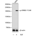 Western Blot - Anti-ERBB2 (phospho Y1248) Antibody (AP0152) - Antibodies.com