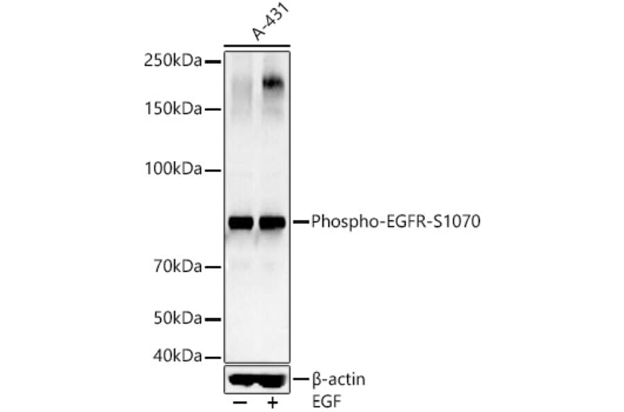 Western Blot - Anti-EGFR (phospho Ser1070) Antibody (A16476) - Antibodies.com