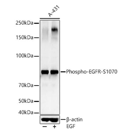 Western Blot - Anti-EGFR (phospho Ser1070) Antibody (A16476) - Antibodies.com