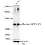 Western Blot - Anti-EGFR (phospho Ser1070) Antibody (A16476) - Antibodies.com