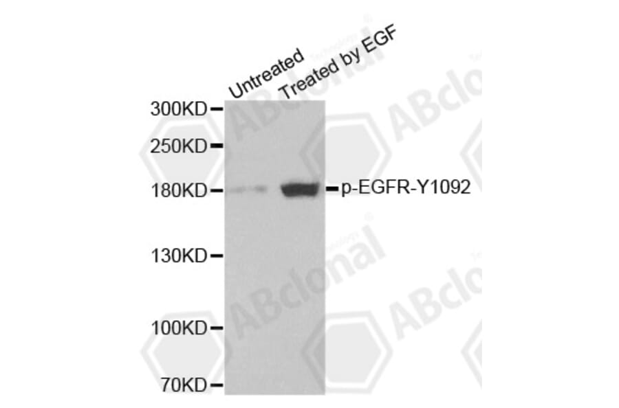 Western Blot - Anti-EGFR (phospho Y1092) Antibody (AP0154) - Antibodies.com