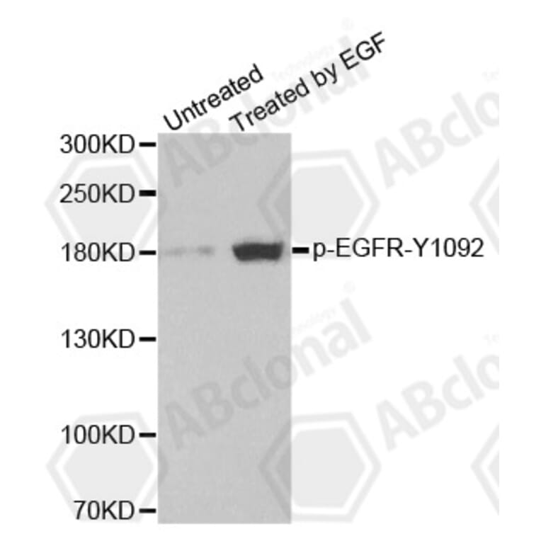 Western Blot - Anti-EGFR (phospho Y1092) Antibody (AP0154) - Antibodies.com