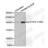 Western Blot - Anti-EGFR (phospho Y1092) Antibody (AP0154) - Antibodies.com