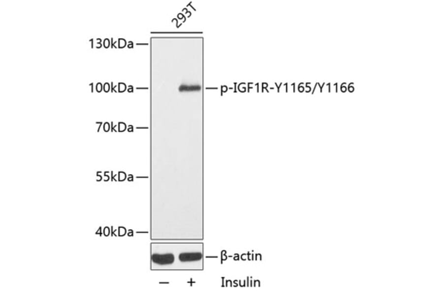 Western Blot - Anti-IGF1R (phospho Y1165 + Y1166) Antibody (AP0155) - Antibodies.com