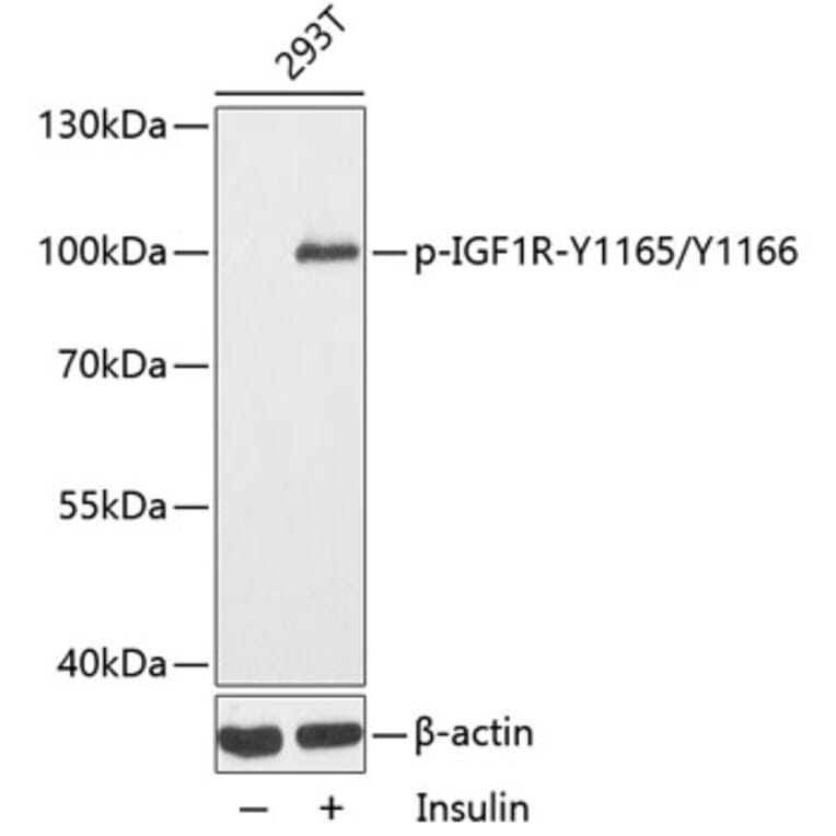 Western Blot - Anti-IGF1R (phospho Y1165 + Y1166) Antibody (AP0155) - Antibodies.com