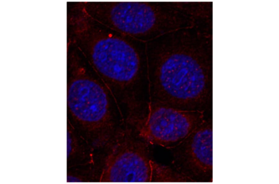 Immunofluorescence - Anti-IGF1R (phospho Y1165 + Y1166) Antibody (AP0155) - Antibodies.com