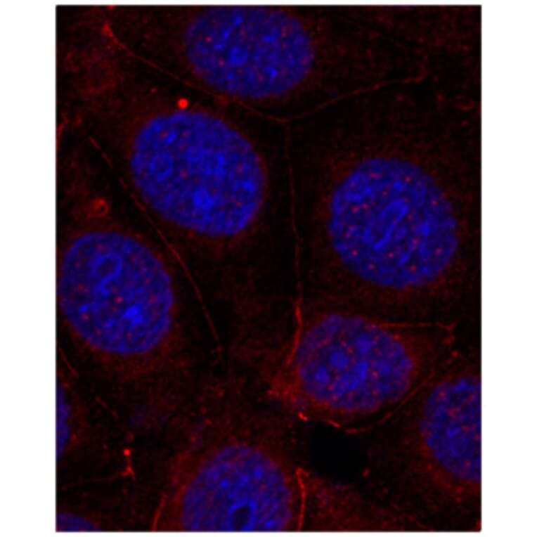 Immunofluorescence - Anti-IGF1R (phospho Y1165 + Y1166) Antibody (AP0155) - Antibodies.com