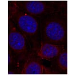Immunofluorescence - Anti-IGF1R (phospho Y1165 + Y1166) Antibody (AP0155) - Antibodies.com