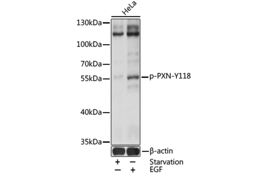 Western Blot - Anti-Paxillin (phospho Tyr118) Antibody (A16479) - Antibodies.com