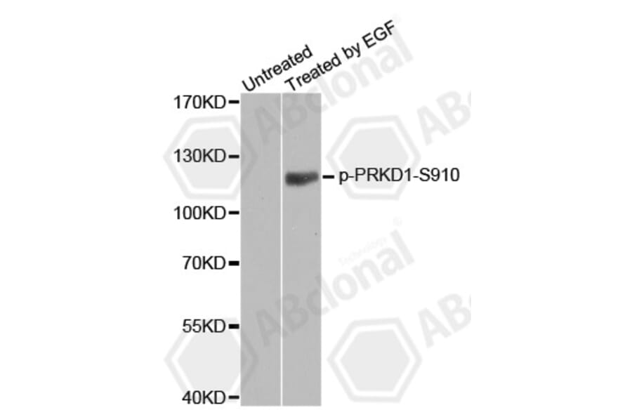 Western Blot - Anti-PRKD1 (phospho S910) Antibody (AP0159) - Antibodies.com