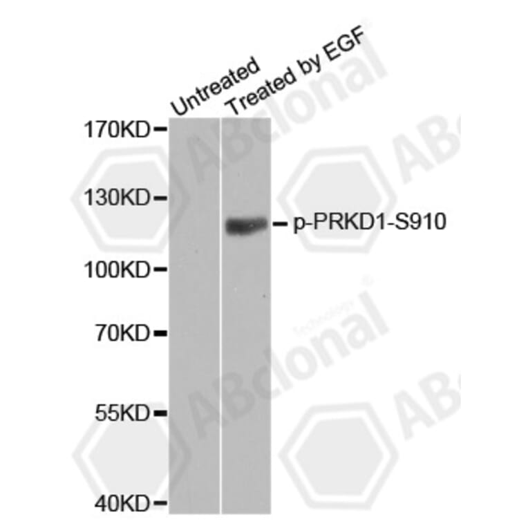 Western Blot - Anti-PRKD1 (phospho S910) Antibody (AP0159) - Antibodies.com