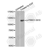 Western Blot - Anti-PRKD1 (phospho S910) Antibody (AP0159) - Antibodies.com