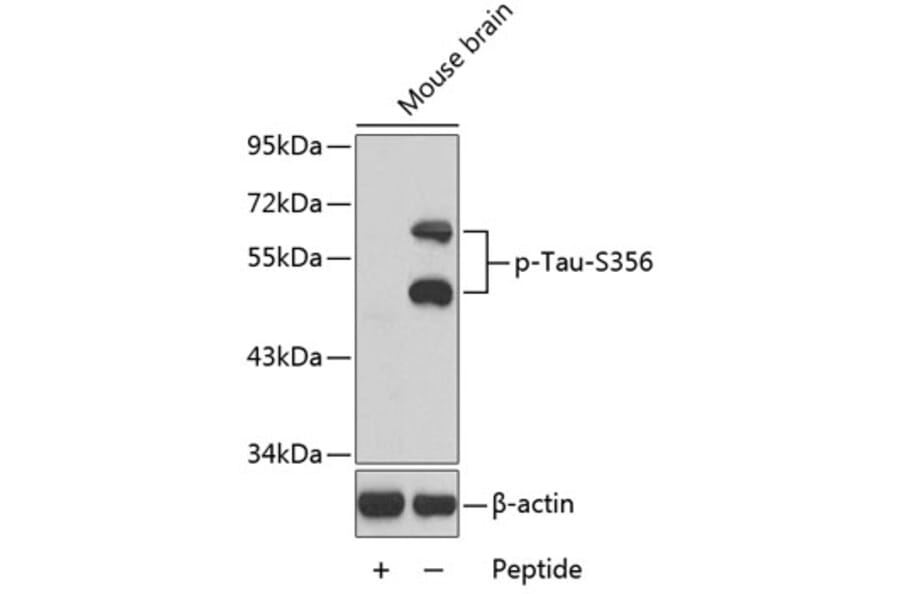 Western Blot - Anti-Tau (phospho S356) Antibody (AP0162) - Antibodies.com
