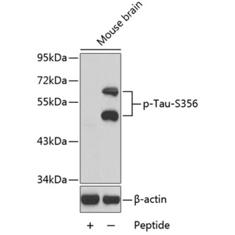 Western Blot - Anti-Tau (phospho S356) Antibody (AP0162) - Antibodies.com