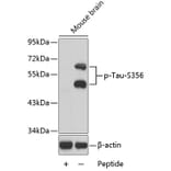 Western Blot - Anti-Tau (phospho S356) Antibody (AP0162) - Antibodies.com