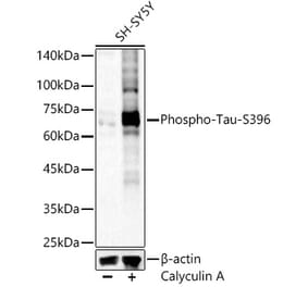 Western Blot - Anti-Tau (phospho Ser396) Antibody (A16482) - Antibodies.com