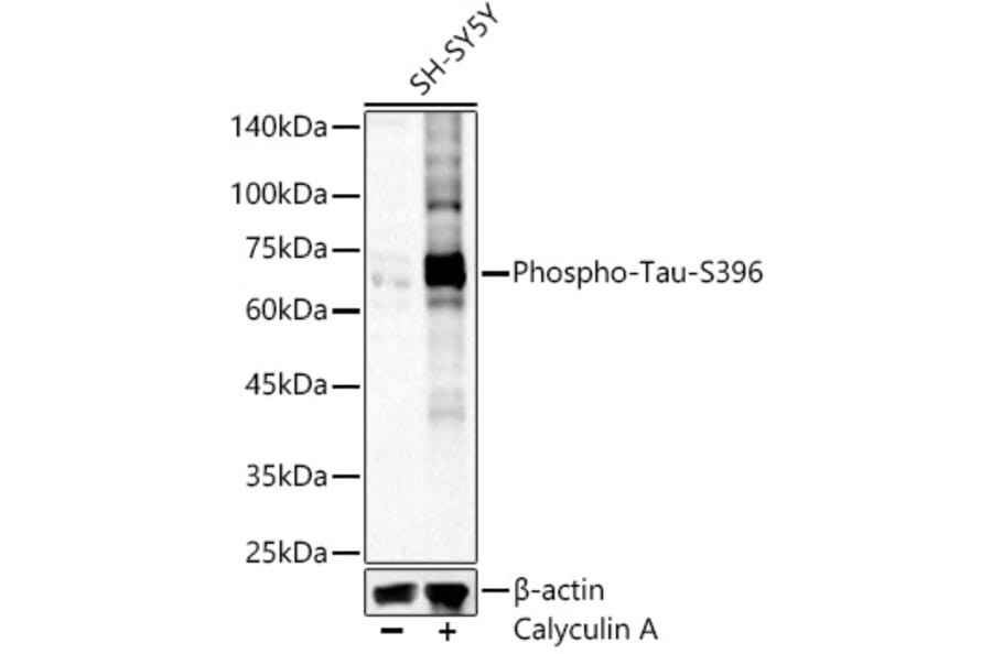 Western Blot - Anti-Tau (phospho Ser396) Antibody (A16482) - Antibodies.com