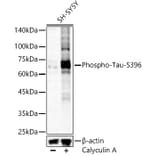 Western Blot - Anti-Tau (phospho Ser396) Antibody (A16482) - Antibodies.com