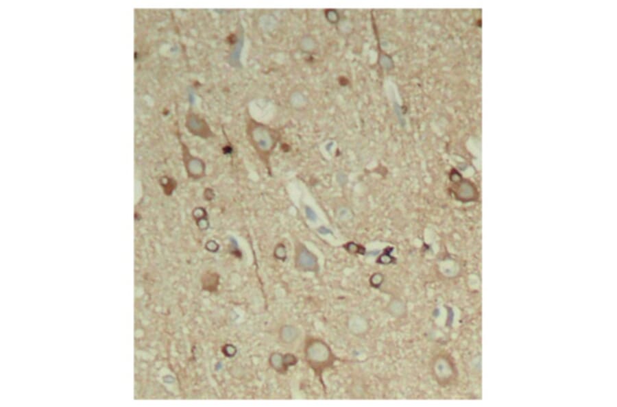 Immunohistochemistry - Anti-Tau (phospho Ser396) Antibody (A16482) - Antibodies.com