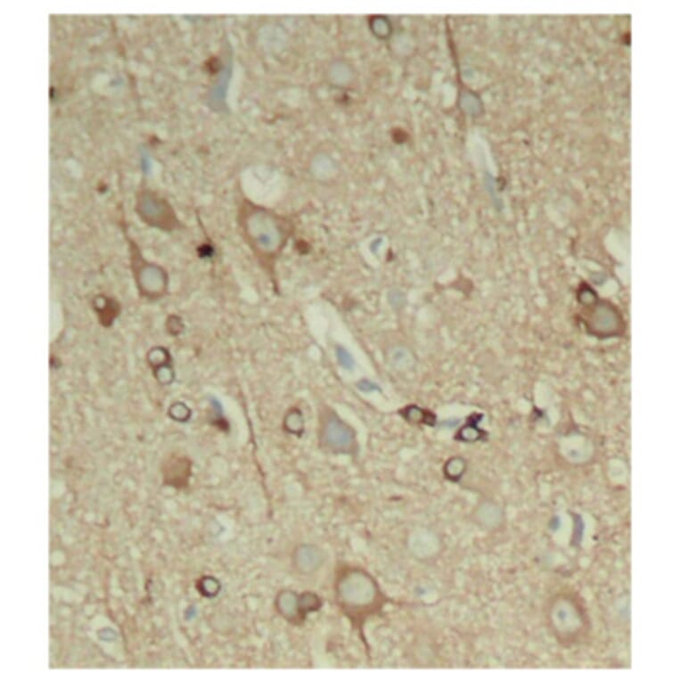 Immunohistochemistry - Anti-Tau (phospho Ser396) Antibody (A16482) - Antibodies.com