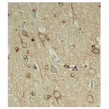 Immunohistochemistry - Anti-Tau (phospho Ser396) Antibody (A16482) - Antibodies.com