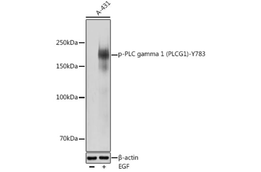 Western Blot - Anti-Phospholipase C gamma 1/PLC-gamma-1 (phospho Tyr783) Antibody (A16483) - Antibodies.com