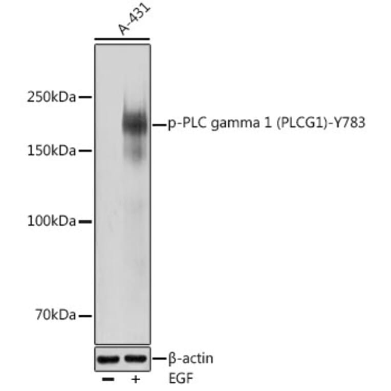 Western Blot - Anti-Phospholipase C gamma 1/PLC-gamma-1 (phospho Tyr783) Antibody (A16483) - Antibodies.com