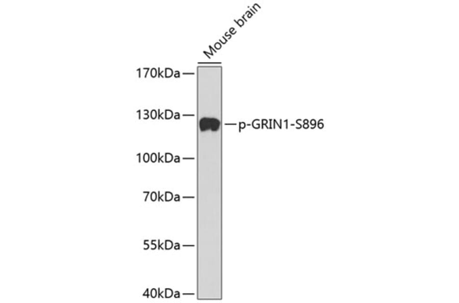 Western Blot - Anti-NMDAR1 (phospho Ser896) Antibody (A16484) - Antibodies.com